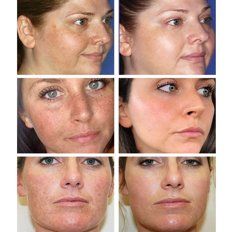 ROTISS Whitening Facial Cleanser Fades Dark Spots & Even Skin Tone