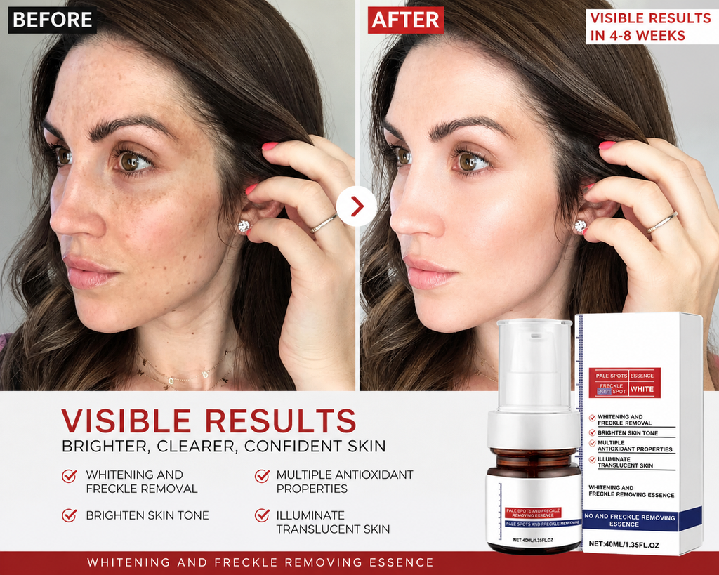 VC Spot-Removing Serum + VC Whitening Freckles Face Cream (Set)