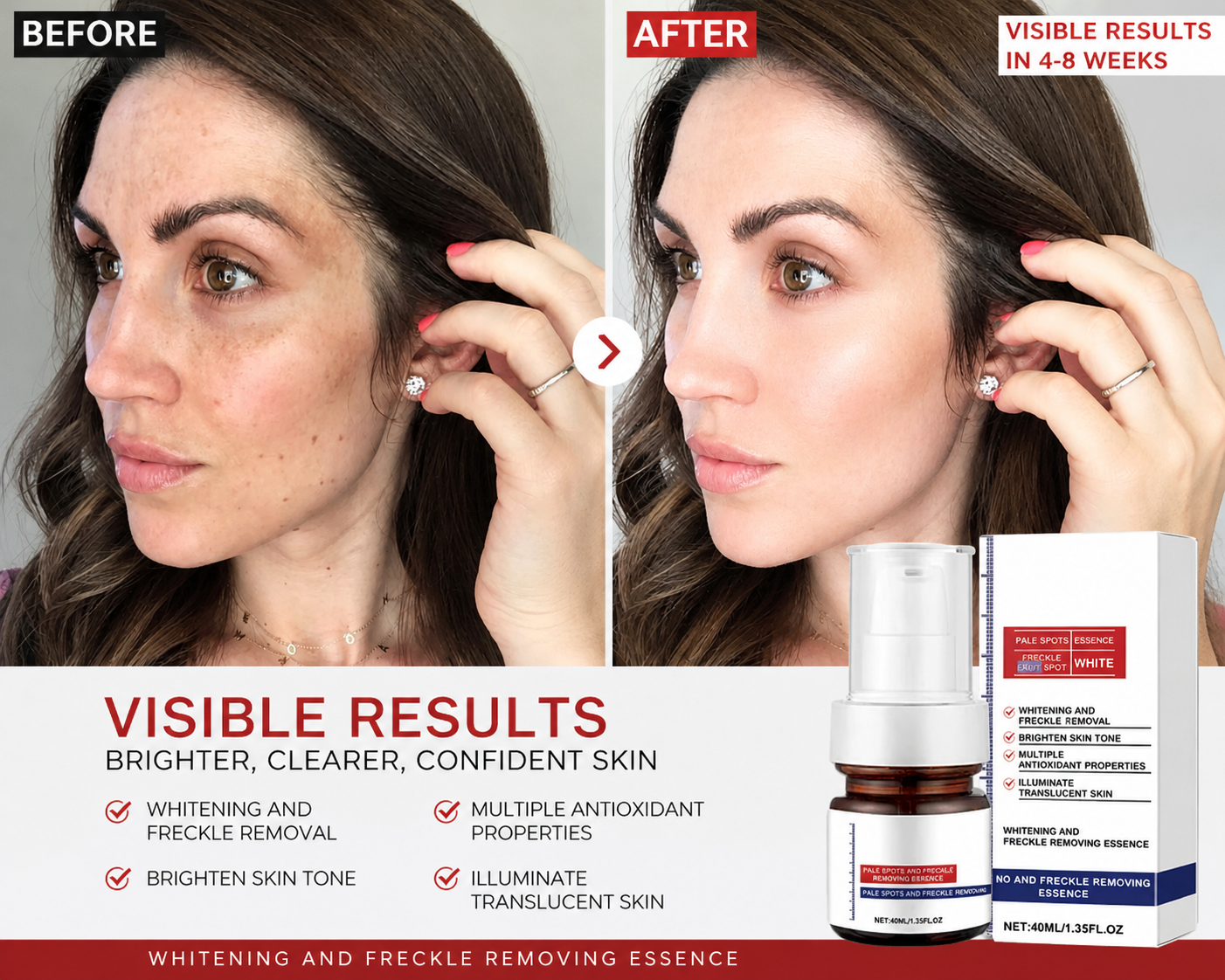 VC Spot-Removing Serum + VC Whitening Freckles Face Cream (Set)