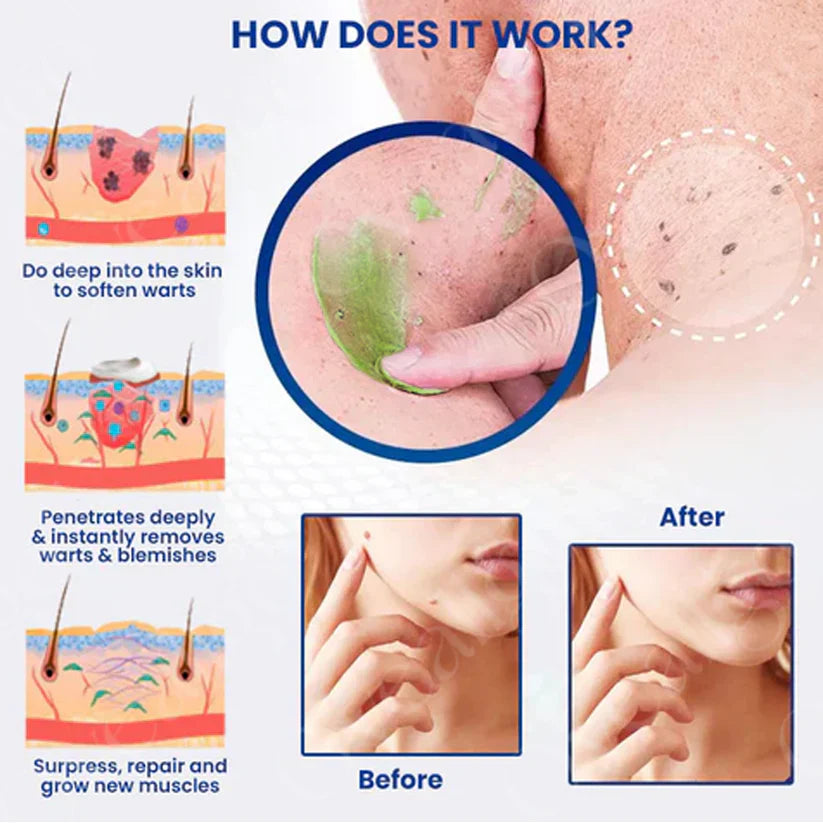 VC Spot-Removing Serum + VC Whitening Freckles Face Cream (Set)