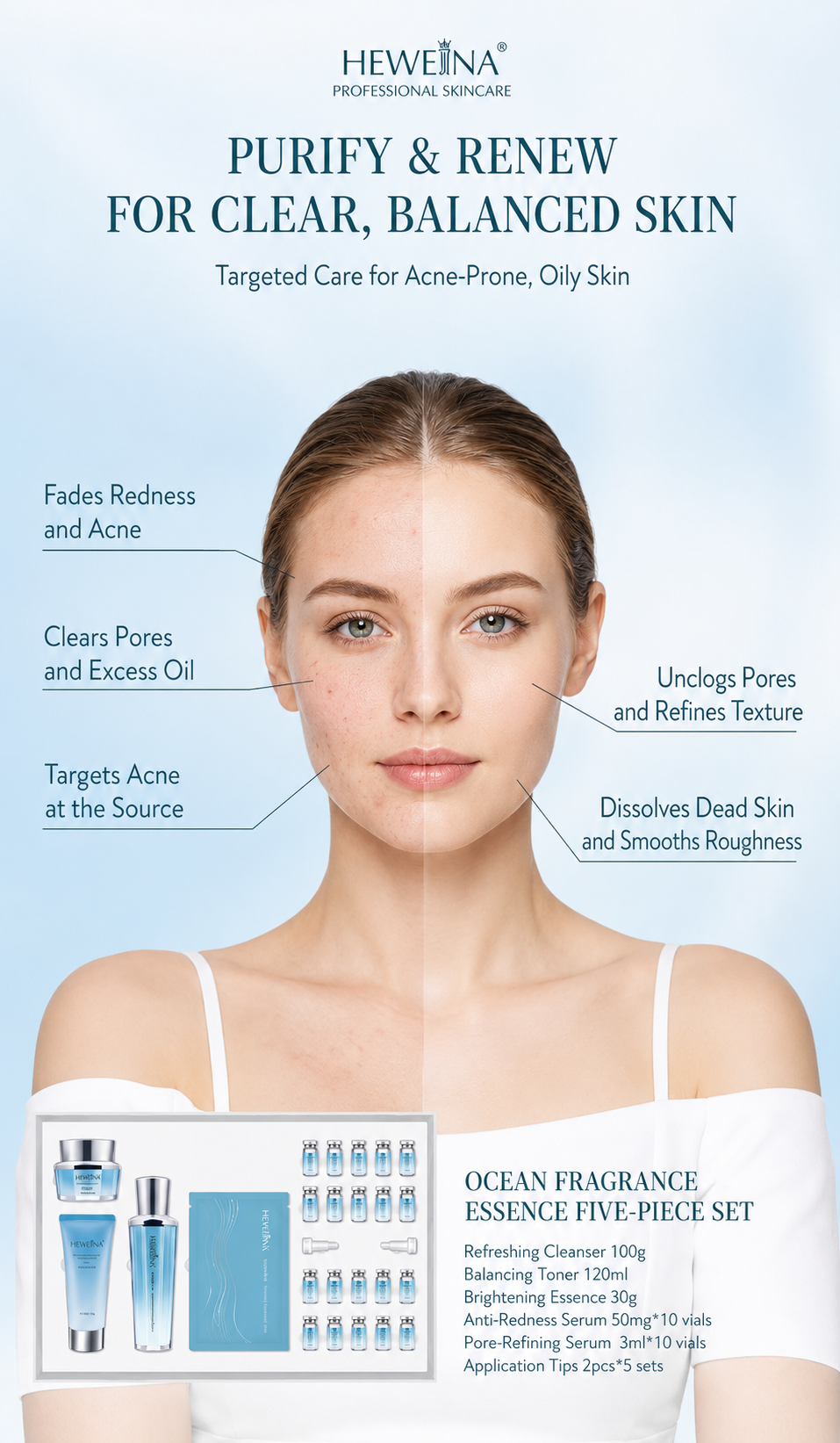 HEWEINA 6-Dimensional Acne Care 5-Piece Ocean Fragrance Skincare Set, Oil Control Pore Minimizing Anti-Redness Cleanser Toner Cream Ampoule Mask Kit