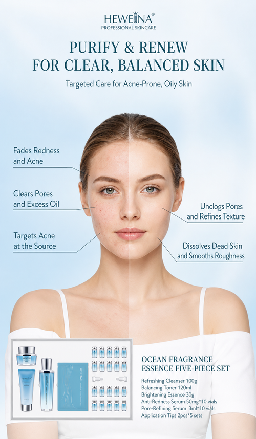 HEWEINA 6-Dimensional Acne Care 5-Piece Ocean Fragrance Skincare Set, Oil Control Pore Minimizing Anti-Redness Cleanser Toner Cream Ampoule Mask Kit