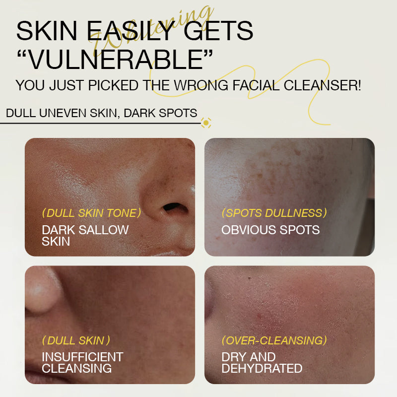 ROTISS Whitening Facial Cleanser Fades Dark Spots & Even Skin Tone