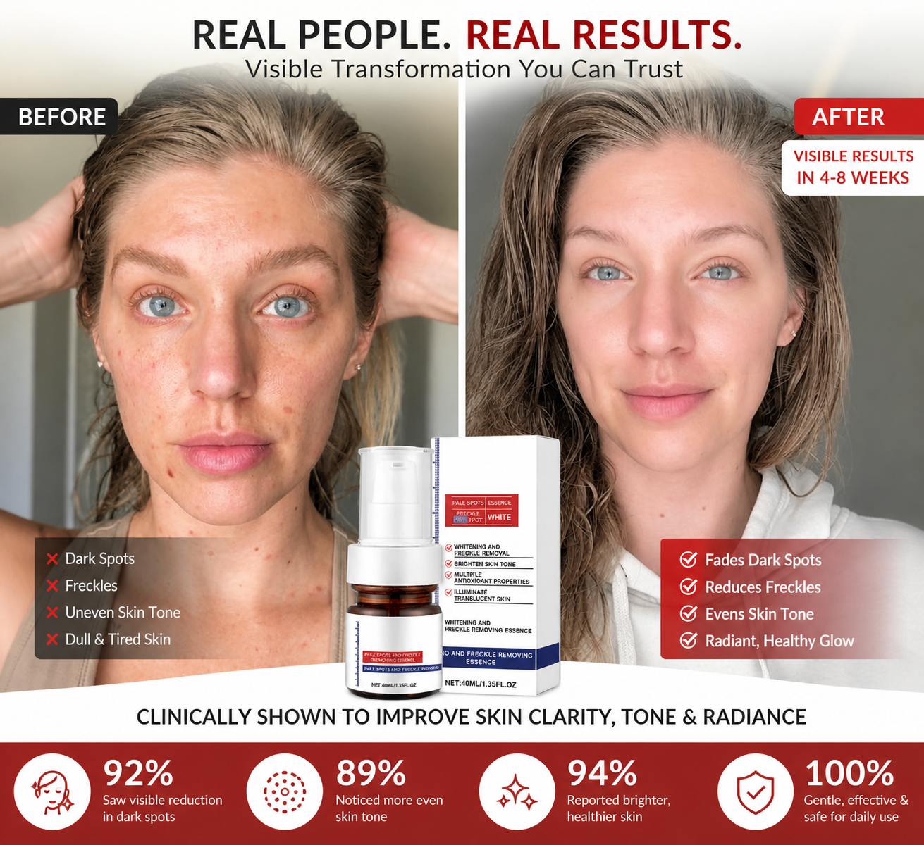 VC Spot-Removing Serum + VC Whitening Freckles Face Cream (Set)
