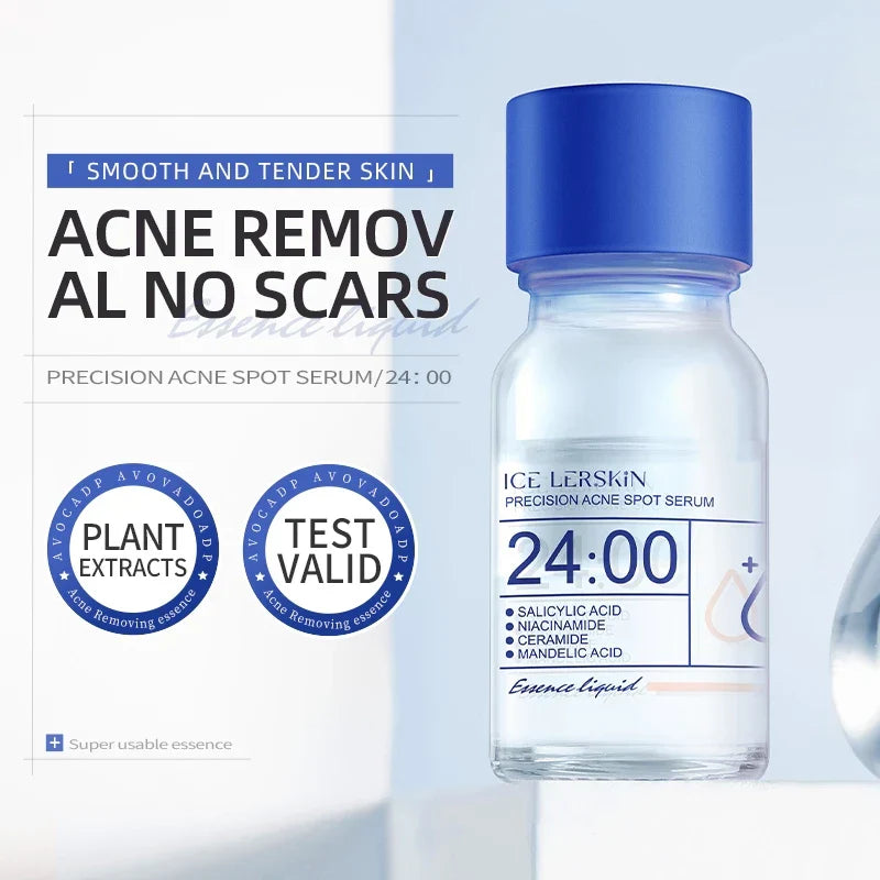 Acne Drying Lotion – Fights Inflamed & Pus-Filled Pimples Fast